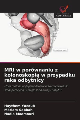 Haythem Yacoub (u. a.) | MRI w porównaniu z kolonoskopi¿ w przypadku raka...