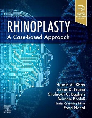 Rhinoplasty: a Case-based approach by Husain Ali Khan Hardcover Book