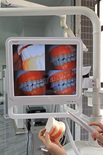 High-quality Digital Dental Intra Oral Camera with Monitor - Picture 1 of 24