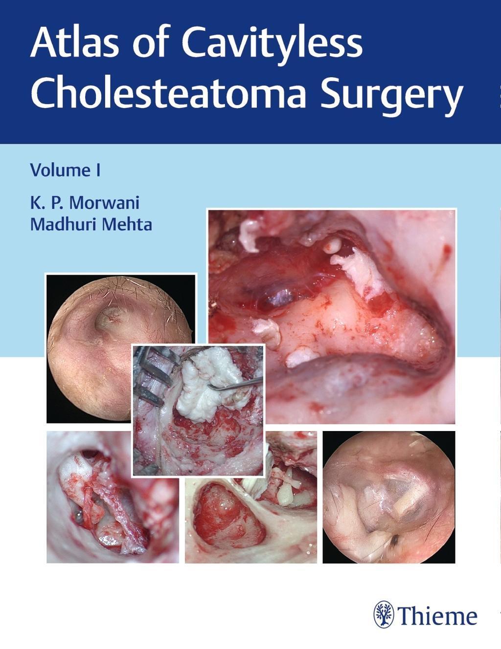 Atlas Of Cavityless Cholesteatoma Surgery, Vol 1 K Morwani