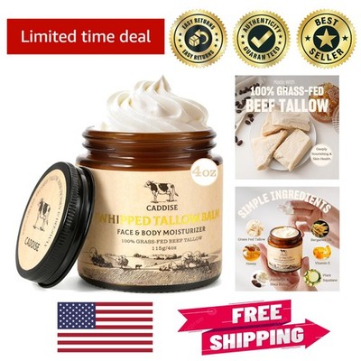 Deeply Nourishing Whipped Beef Tallow - Handmade Cream for All Skin Types - 4 Oz