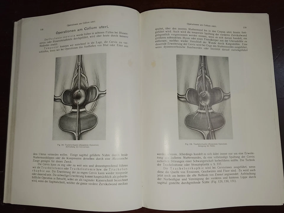Gynäkologische Operationslehre (Chirurgia ginecologica), J. Halban, usato - Immagine 4 di 4