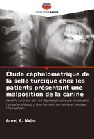 ÉTude CéPhaloméTrique De La Selle Turcique Chez Les Patients PréSentant Une Malp