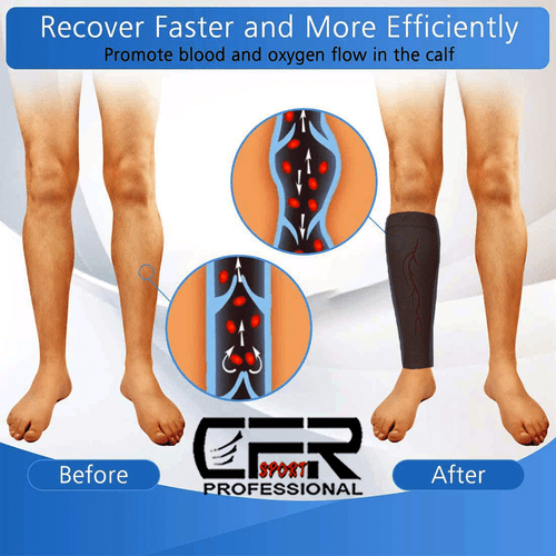 Wadenärmel Beinstütze Kompressionsstrümpfe Laufen Schienbeinschiene Krampfadern Paar - Bild 5 von 14