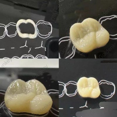 Dental Composite Filling Practise Template Board Model Student Practice