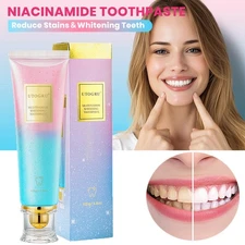 Niacinamide Whitening Toothpaste,Natural Niacinamide Toothpaste,Teeth Whitening