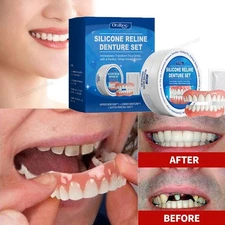 Denture Reline Kit Instant Teeth For Men And Women Denture Snap False Teeth Set