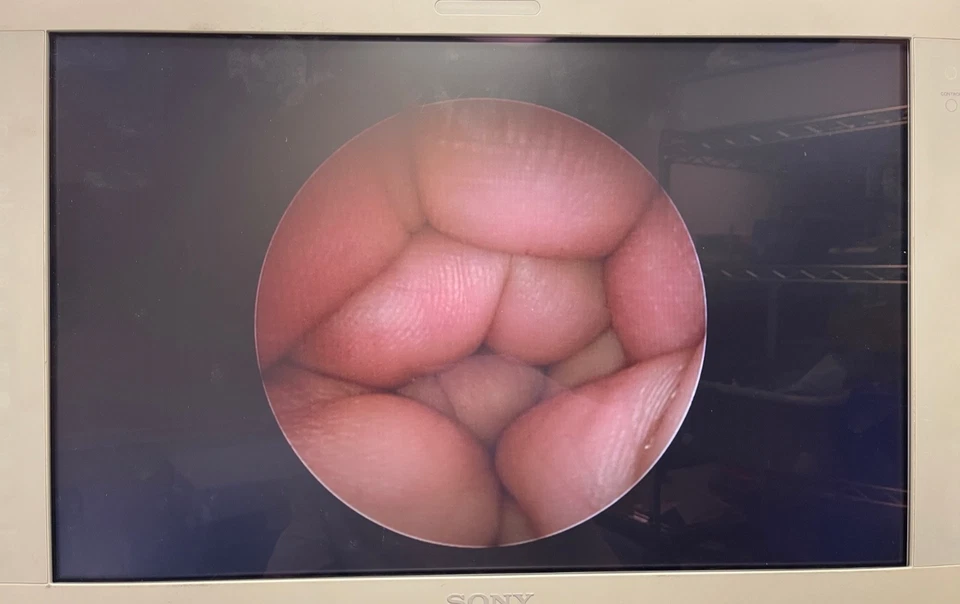 Conmed Linvatec T2930 Autoclavable Arthroscope Set w/ Hardware Light Cord & Case - Image 3 of 4