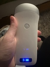 portable wifi ultrasound scanner