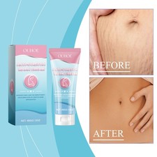 Stretch Mark Cream Moisturizing Smoothing Body Skin Care for Women 60g