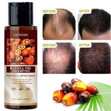 Batana Oil Shampoo For Hair Growth Repairing Nourishing Scalp Batana Oil Shampoo