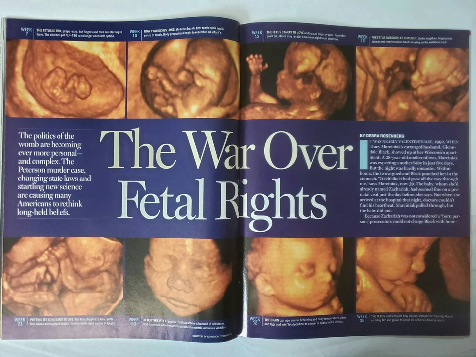 Should A Fetus Have Rights? NEWSWEEK Magazine June 9 2003 - F461 - Image 2 of 3