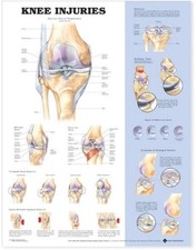 Knee Injuries Anatomical Chart Poster  UK IMPORT 