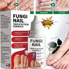 Fungi-Nail Anti-Fungal Liquid Solution Kills Fungus That Can Lead To Nail