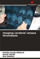 Imaging Cerebral Venous Thrombosis Khadija Sonda Moalla