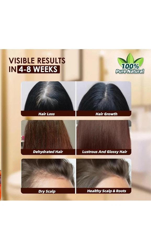 Batana Oil Shampoo And Conditioner Thickening Hair Bundle For Stronger Hair - Image 4 of 4