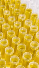 The Shepherd’s Holy Anointing Oil with Real Frankincense 7ml+ (Approx. 1/4oz)