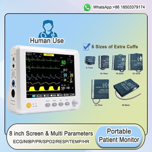 Monitor portátil de signos vitales de 8 pulgadas ECG multiparámetro/PR/SPO2/RESP/TEMP - Imagen 8 de 10