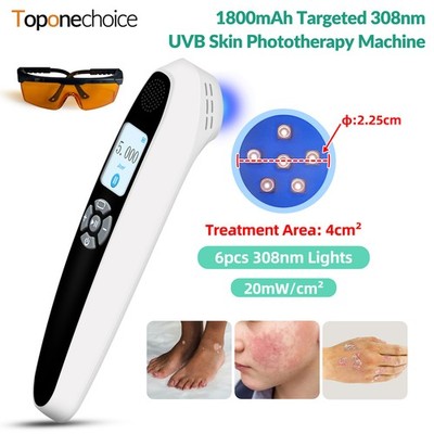 6 Dioden Handliches 308nm UVB Lichttherapie Gerät für gezielte Hautpflege