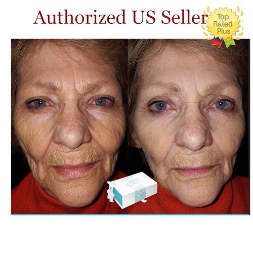Instantly Ageless 10 Fläschchen, Facelift, Faltenentferner in Sekunden - Bild 8 von 9