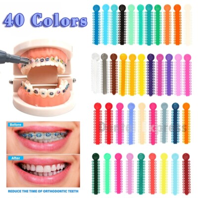 Ortho Module Red 1040 Dental Orthodontic Elastic Ligature Ties Braces Elastomeric ...