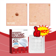 Microneedles Botanical Skin Tag Removal Patch - Quick Acting- 9pcs/Box Hot Hot
