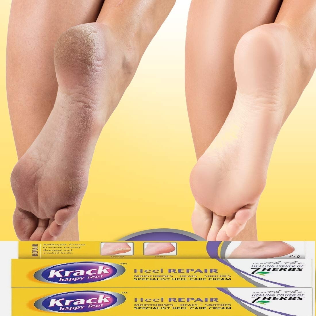 Krack Heel Repair, Ayurvedic Foot care cream, 25 Gm PACK OF