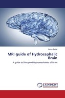 Amna Babar | MRI Guide Of Hydrocephalic Brain | Taschenbuch | Englisch (2020)