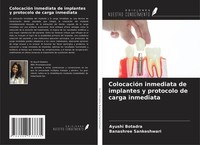 ColocacióN Inmediata De Implantes Y Protocolo De Carga Inmediata Banashree Sanke