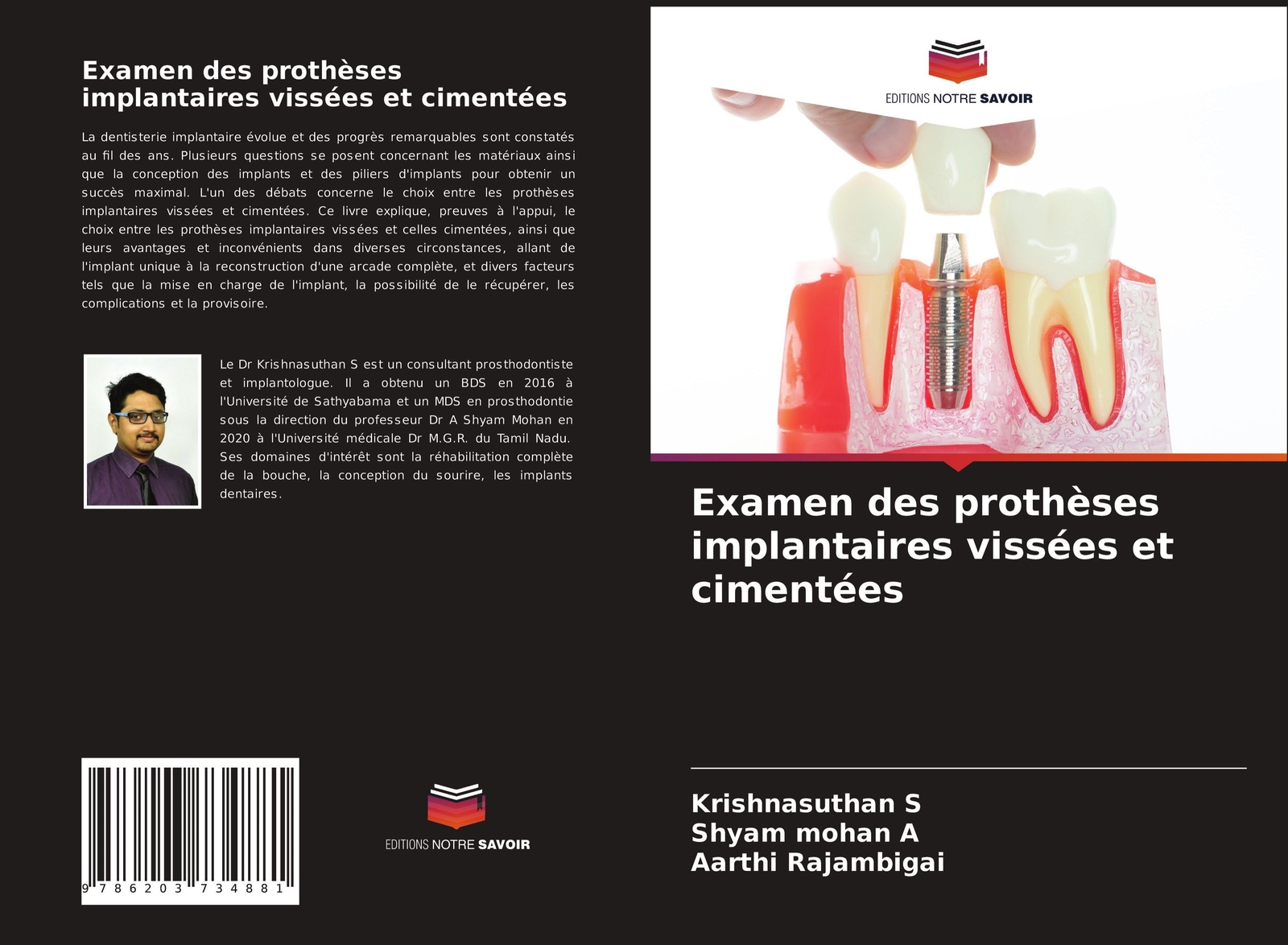 Examen Des Prothèses Implantaires Vissées Et Cimentées Krishnasuthan S