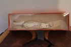 Antique Vintage the Original Doctor Spoon  Little Doctor #275 Silver Scale — photo 1