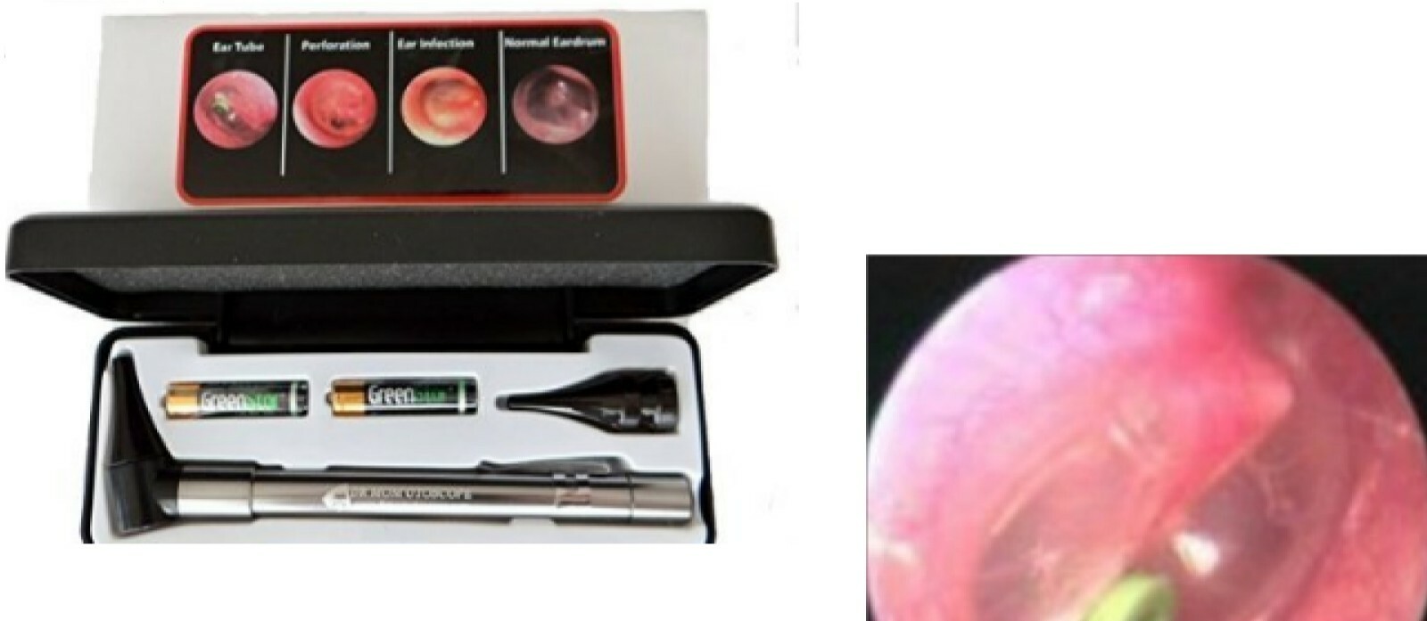 Dr Mom Stainless LED Otoscope Otoscopes with Hard Case Third Generation