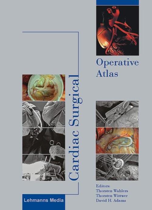 Thumbnail - Cardiac Surgical Operative Atlas | Thorsten Wahlers (u. A.) | Englisch