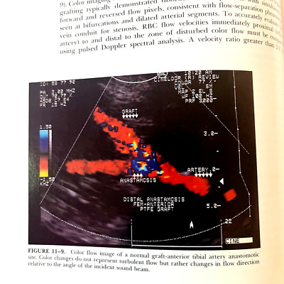 Vintage Technologies in Vascular Surgery Book Hardcover James S. T. Yao 1992
