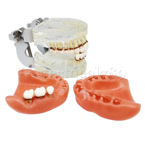 Dental Orthodontics Implant Study Model Analysis Demonstration Tooth Teaching - Picture 2 of 158