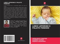 LÁBio Leporino E Palato Fendido Uppalapati Vinutna
