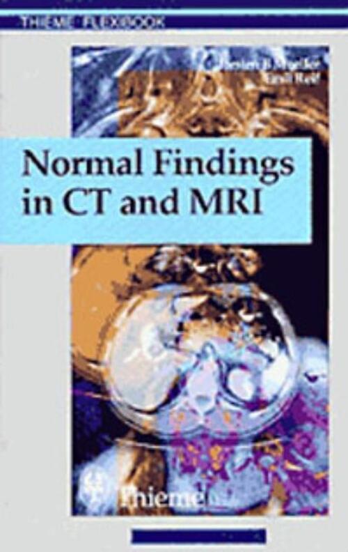 Normal Findings In Ct And Mri, A1, Print | Torsten Bert Möller (u. A.)