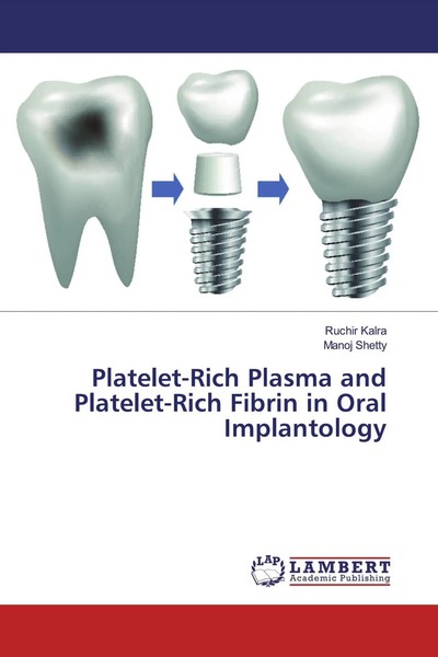 Platelet-Rich Plasma And Platelet-Rich Fibrin In Oral Implantology Kalra (U. A.)-image