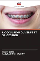 Anany Omar (U. A.) | L'occlusion Ouverte ET SA Gestion | Taschenbuch (2023)