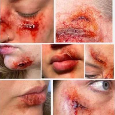 The Nicks & Cuts (7er Set) | SFX Make Up Gesichtsverletzung | Silikonprothesen