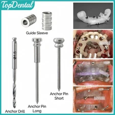 ⌀1.5 Dental 3DDX Anchor Pin Fixation Drill Guided Sleeves Implant Denture Plate