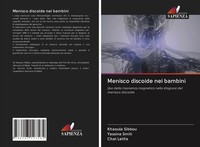 Menisco Discoide Nei Bambini Khaoula Sibbou