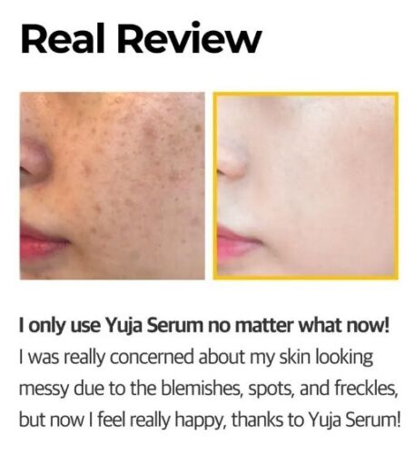 SOME BY MI Yuja Niacin Anti Blemish Serum 50ml - 第 7/24 張圖片