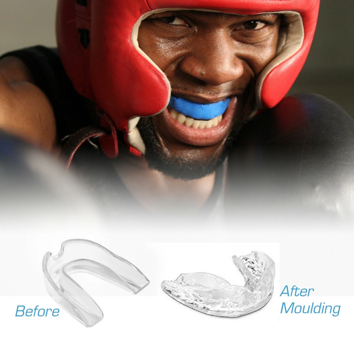 17+ Custom Mouthguards Boxing