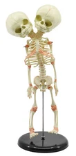 Infant Fetus Skeleton Model, Mini Size - Twin, Conjoined Skull - Eisco Labs