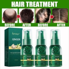 3pcs Hair Growth Dense Ginger Serum Anti-Loss Treatment Essence Spray Women Men