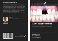 Akshay D. Joshi (U. A.) | Fallos DE LOS Implantes | Taschenbuch | Spanisch