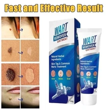 Wart Remover Fast Acting Gel Wart Remover Freeze Off - Fast-Acting Wart Ointment