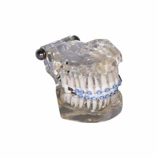 Redland B7-03 Dental Demonstration Teeth Educational Model