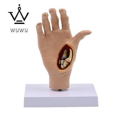 1:1 Hand Bone Joint Model Pathological Deformed Hand Bone Skeleton Hand Tendon
